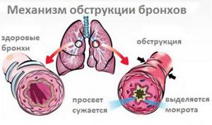 астма у детей симптомы лечение комаровский