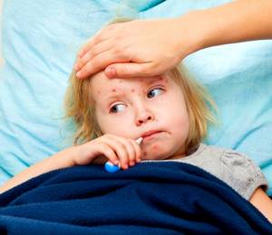 вторичная ветрянка у детей симптомы лечение